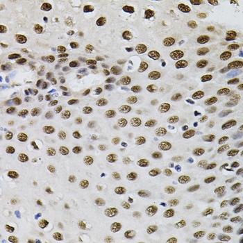 GTF2I Antibody