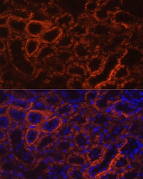 GTF2I Antibody