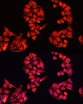 ALDH9A1 Antibody