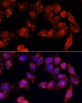ACVR2B Antibody