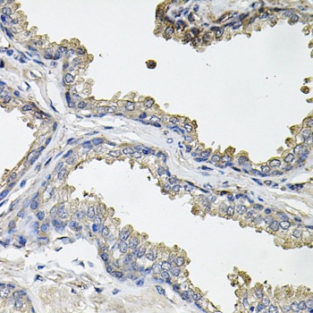 ACO1 Antibody