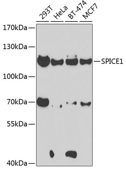 SPICE1 Antibody