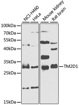 TM2D1 Antibody