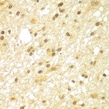 TBL1XR1 Antibody
