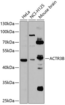 ACTR3B Antibody
