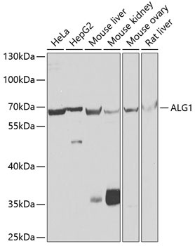 ALG1 Antibody