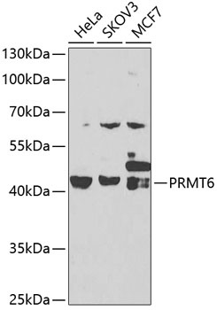 PRMT6 Antibody