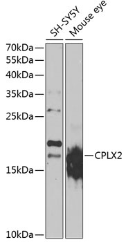 CPLX2 Antibody