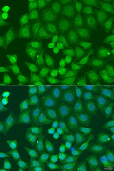 ZFYVE16 Antibody