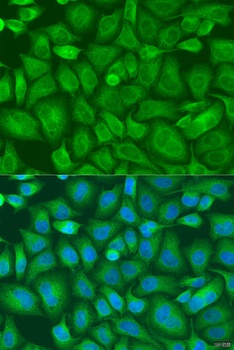 BAG2 Antibody