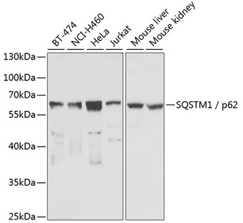 SQSTM1 Antibody