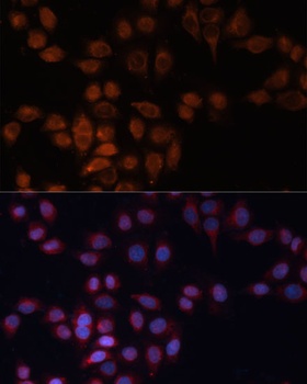 ADAM15 Antibody