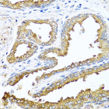 NCK2 Antibody