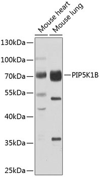 PIP5K1B Antibody
