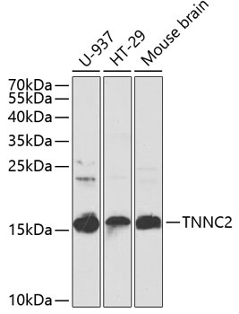 TNNC2 Antibody