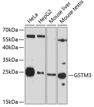 GSTM3 Antibody