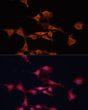 GSTM3 Antibody