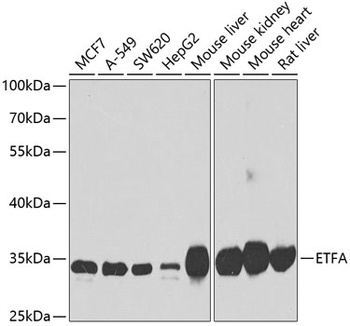 ETFA Antibody