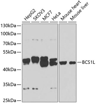 BCS1L Antibody