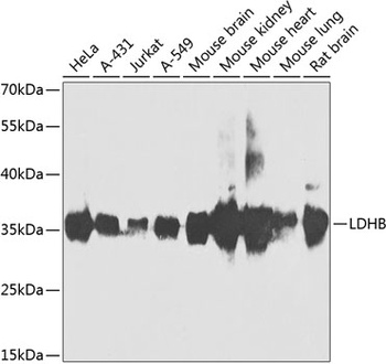 LDHB Antibody