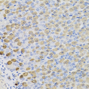 LDHB Antibody