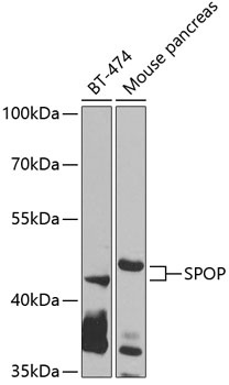 SPOP Antibody