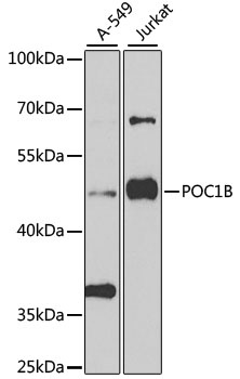 POC1B Antibody