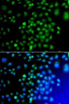 ATF7 Antibody