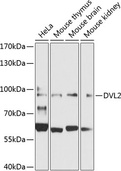 DVL2 Antibody