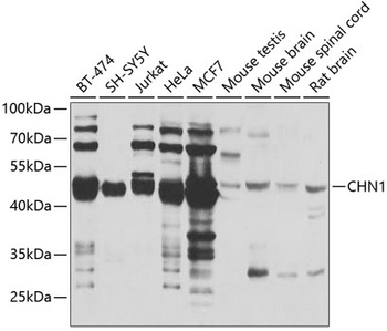 CHN1 Antibody