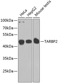 TARBP2 Antibody
