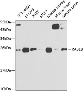 RAB1B Antibody