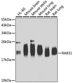 RAB31 Antibody