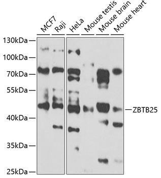 ZBTB25 Antibody