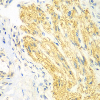 PTK6 Antibody
