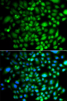 PTK6 Antibody