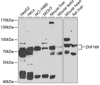 ZNF169 Antibody