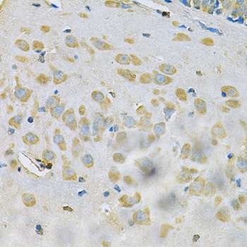 SAR1A Antibody