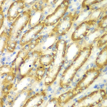 TM9SF1 Antibody