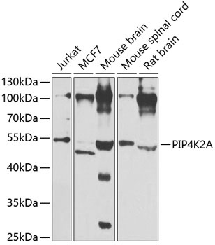 PIP4K2A Antibody