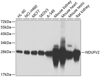 NDUFV2 Antibody