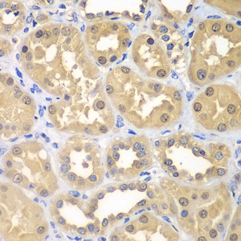 KHK Antibody