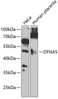 DFNA5 Antibody