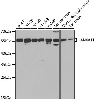 ANXA11 Antibody