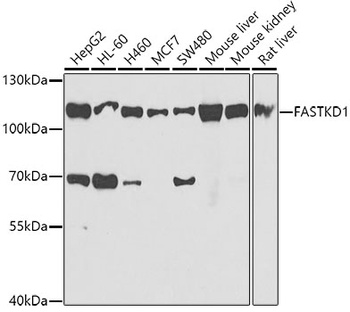 FASTKD1 Antibody