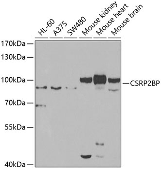 CSRP2BP Antibody