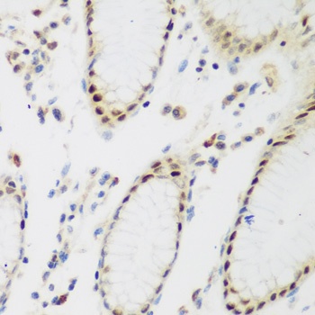PPAN Antibody
