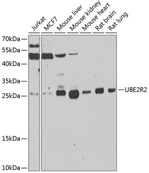 UBE2R2 Antibody