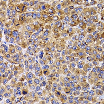 UBE2R2 Antibody
