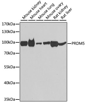 PRDM5 Antibody